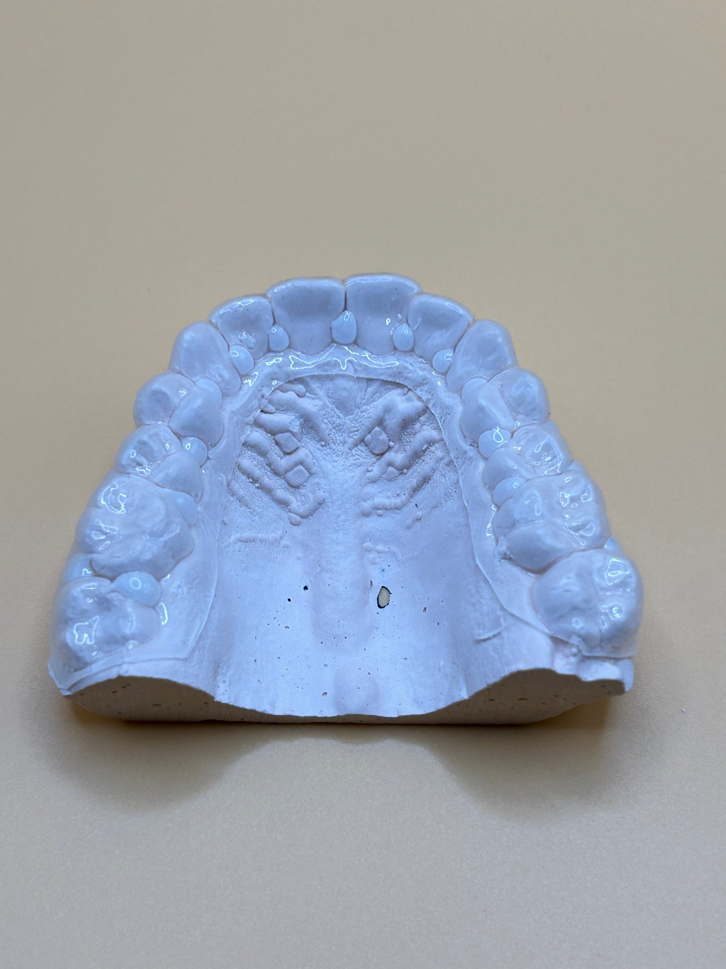Cubetas personalizadas y Perio Restore® Gel: una gran solución para mantener la enfermedad periodontal bajo control